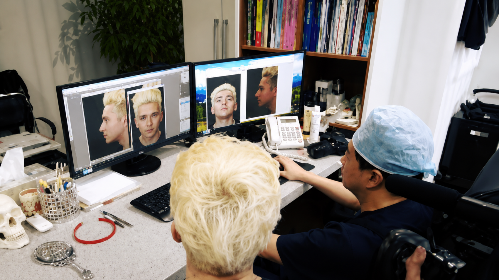 Rhinoplasty Consultation Rhinoplasty Consultation
