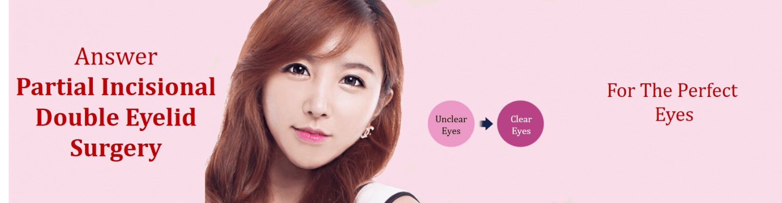 partial incision double eyelid surgery