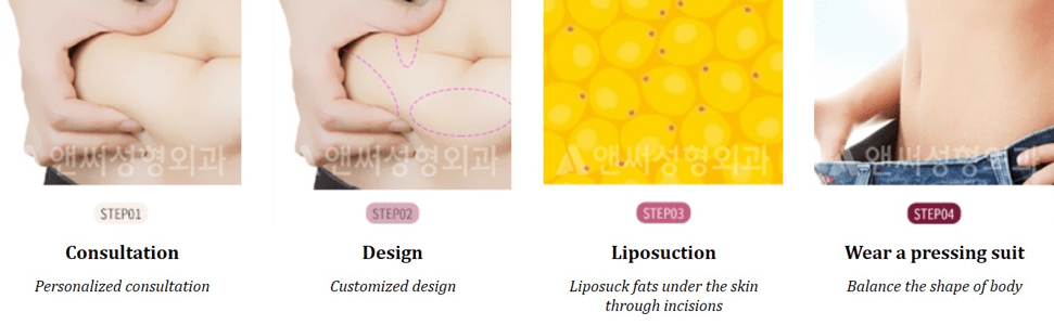 Liposuction in Korea