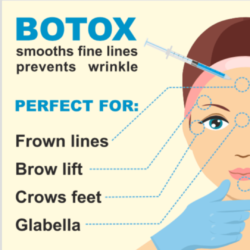 Botox - Quick Facts You Should Know About Botox in Korea