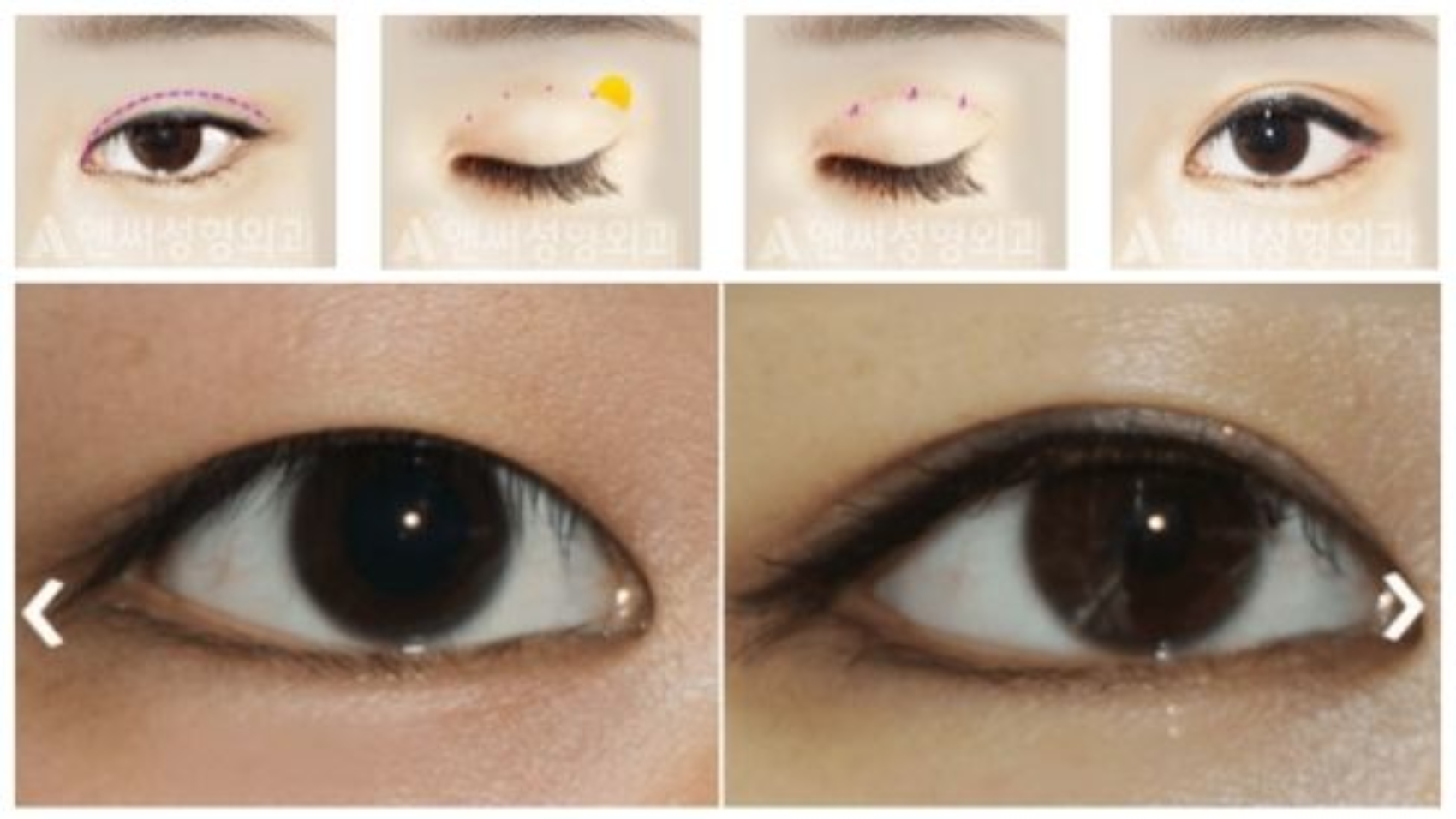 Asian double eyelid clearance makeup