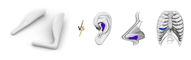 Why are Silicone Implants Usually Better than Cartilage Grafts When Enhancing the Nose Bridge?