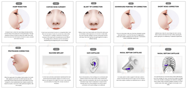 Rhinoplasty in Korea: Your 2024 Guide to Getting the Procedure